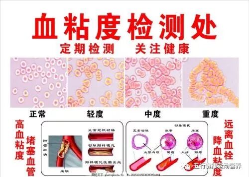 很容易被忽视的血液指标 五行健康运动营养 微信公众号文章阅读 Wemp