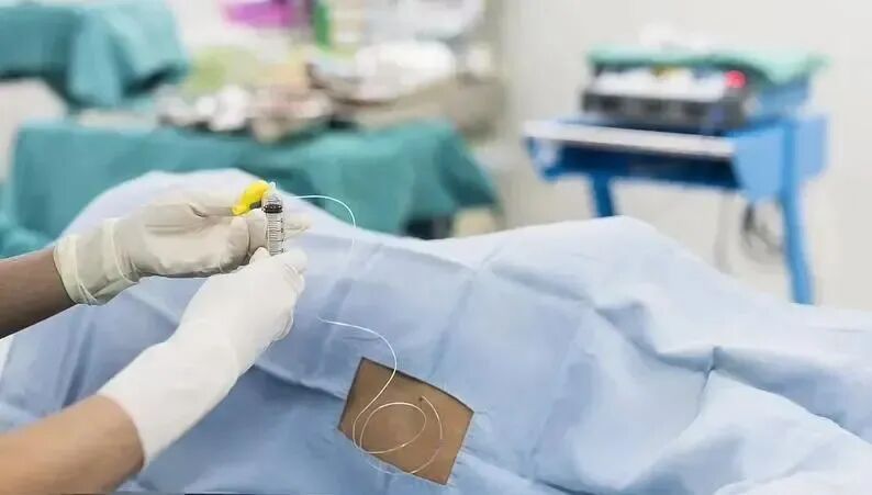 怎么知道穿刺到硬膜外产科麻醉 ｜ 分娩镇痛操作问题解析（二）_https://www.jmylbn.com_新闻资讯_第4张