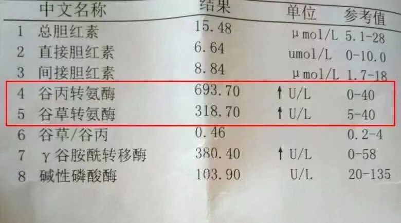 转氨酶升高怎么办?3个好办法，降转氨酶不再难