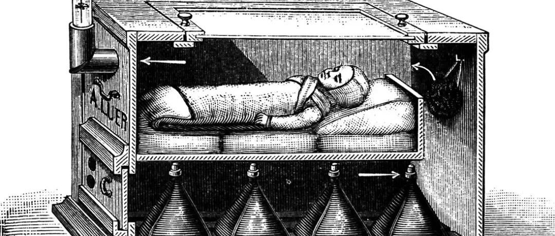 人造子宫（体外妊娠）技术发展简史