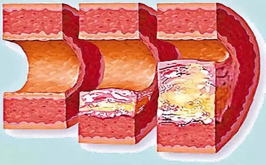 医讯怎么用【三氧医讯】2022三氧疗法在临床中的妙用_https://www.jmylbn.com_新闻资讯_第9张