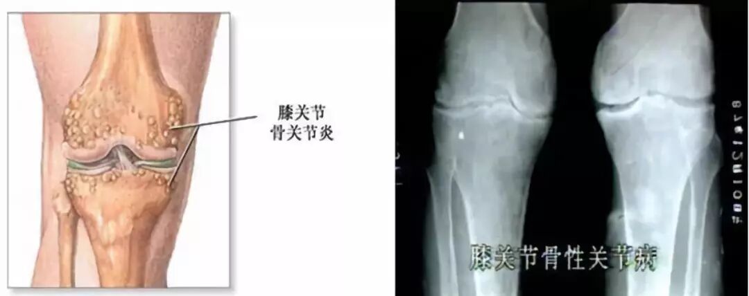 医讯怎么用【三氧医讯】2022三氧疗法在临床中的妙用_https://www.jmylbn.com_新闻资讯_第7张