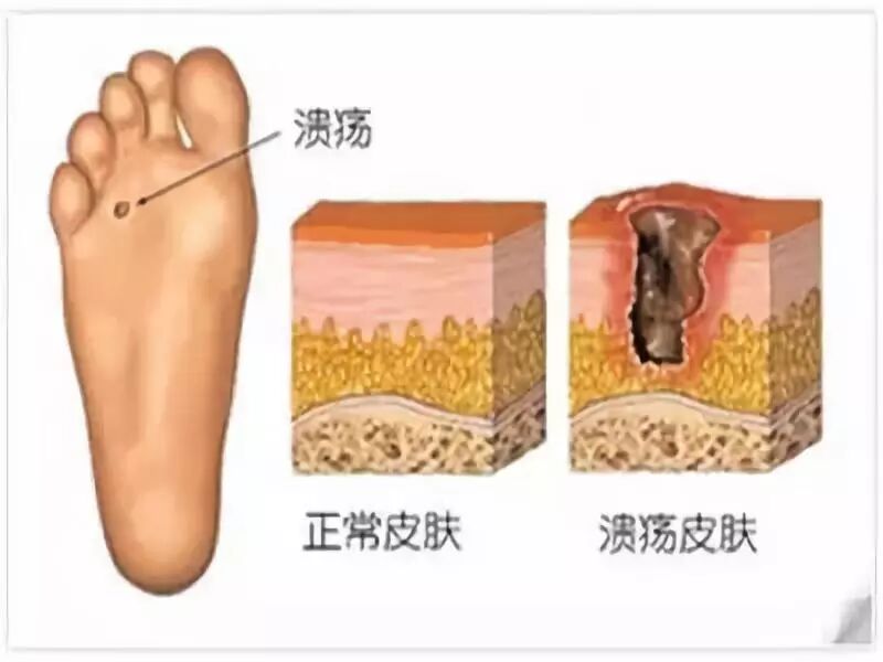 医讯怎么用【三氧医讯】2022三氧疗法在临床中的妙用_https://www.jmylbn.com_新闻资讯_第12张