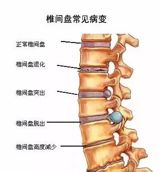医讯怎么用【三氧医讯】2022三氧疗法在临床中的妙用_https://www.jmylbn.com_新闻资讯_第6张