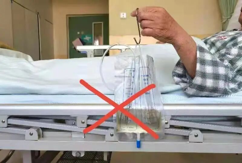 医用引流管什么样的【省立科普】福建省立医院护理专家教你如何家庭保“管”_https://www.jmylbn.com_新闻资讯_第6张