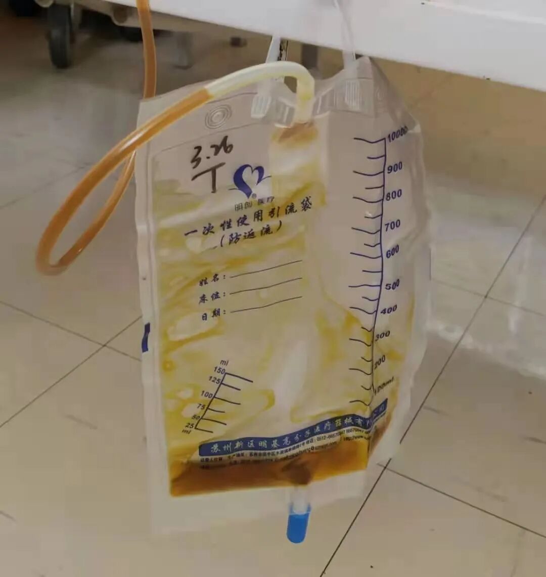 医用引流管什么样的【省立科普】福建省立医院护理专家教你如何家庭保“管”_https://www.jmylbn.com_新闻资讯_第10张