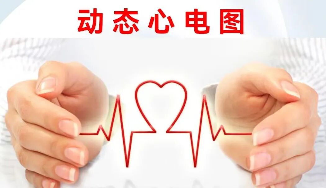 动态心电图自己怎么记录长时程动态心电图——您的心脏“记录仪_https://www.jmylbn.com_新闻资讯_第2张