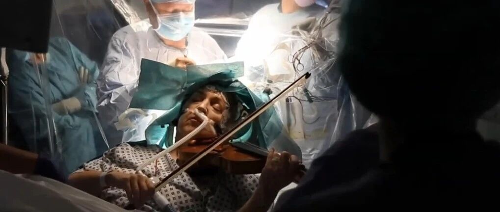 这病人太霸气，一边开颅手术一边拉小提琴，什么缘由