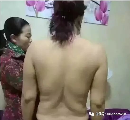 理疗仪怎么治头痛TBS理疗仪+精油开背后，免疫力提升了，不再怕感冒，失眠头痛，肠胃不适，长期便秘，经期疼痛，月经不调，肩颈酸痛....._https://www.jmylbn.com_新闻资讯_第5张