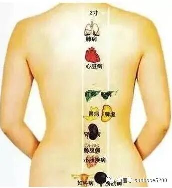 理疗仪怎么治头痛TBS理疗仪+精油开背后，免疫力提升了，不再怕感冒，失眠头痛，肠胃不适，长期便秘，经期疼痛，月经不调，肩颈酸痛....._https://www.jmylbn.com_新闻资讯_第3张