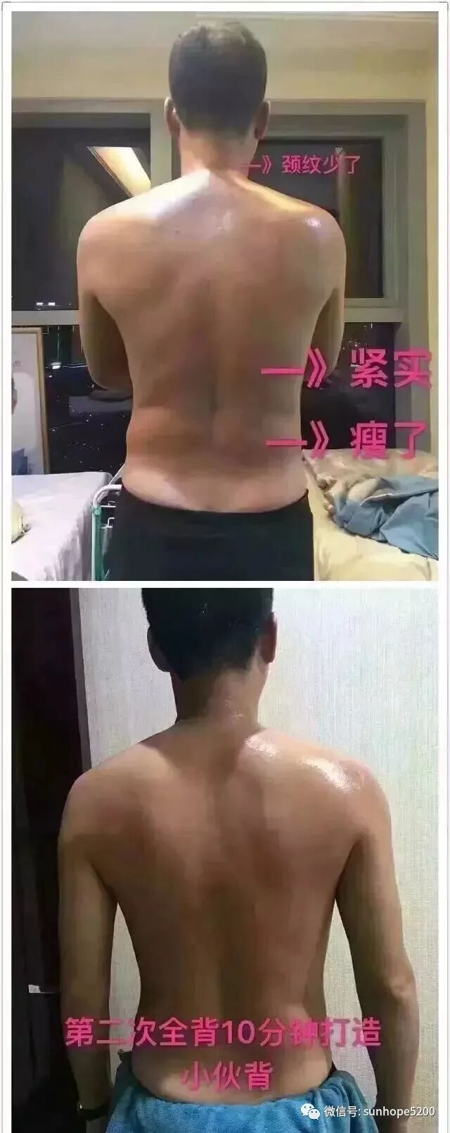 理疗仪怎么治头痛TBS理疗仪+精油开背后，免疫力提升了，不再怕感冒，失眠头痛，肠胃不适，长期便秘，经期疼痛，月经不调，肩颈酸痛....._https://www.jmylbn.com_新闻资讯_第4张