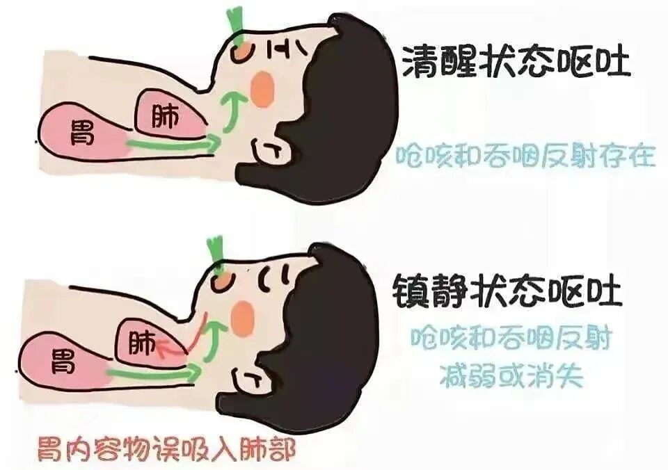 怎么区分显微剪刀揪心 ｜ 他才2岁多，竟敢用剪刀剪断小拇指！_https://www.jmylbn.com_新闻资讯_第14张