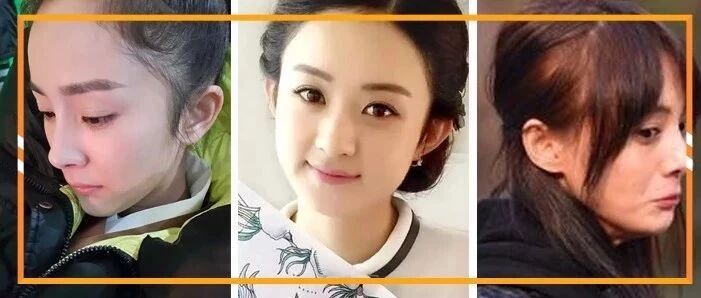 都9012年了，你还在担心脱发问题吗？