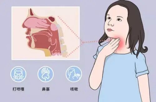 上呼吸道感染会引起什么症状？应该吃什么消炎药呢？