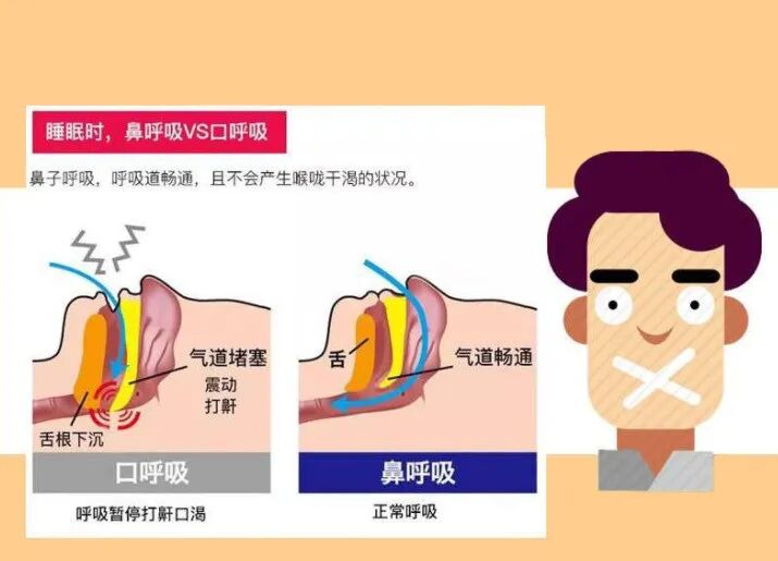 瑞思迈睡眠报告怎么看如何告别打鼾？瑞思迈家用呼吸机了解一下~_https://www.jmylbn.com_新闻资讯_第1张