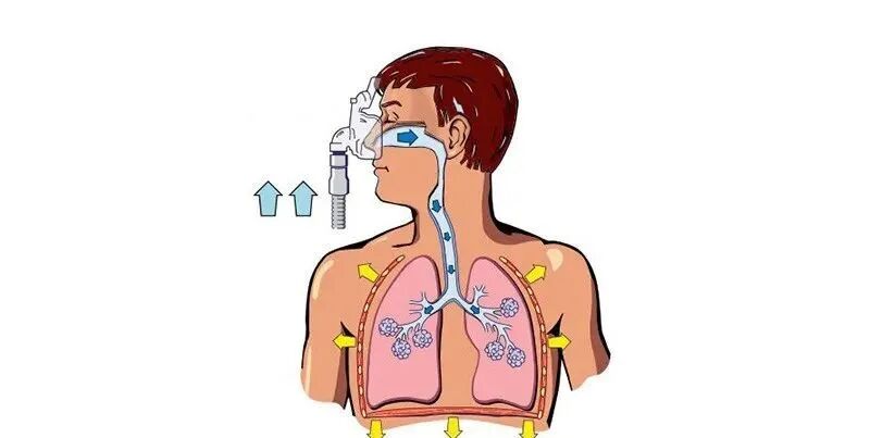 什么呼吸机好用家用呼吸机有什么效果？真的那么好用吗？_https://www.jmylbn.com_新闻资讯_第3张