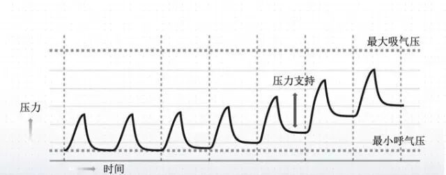 单水平呼吸机怎么使用一篇文章读懂双水平呼吸机_https://www.jmylbn.com_新闻资讯_第3张