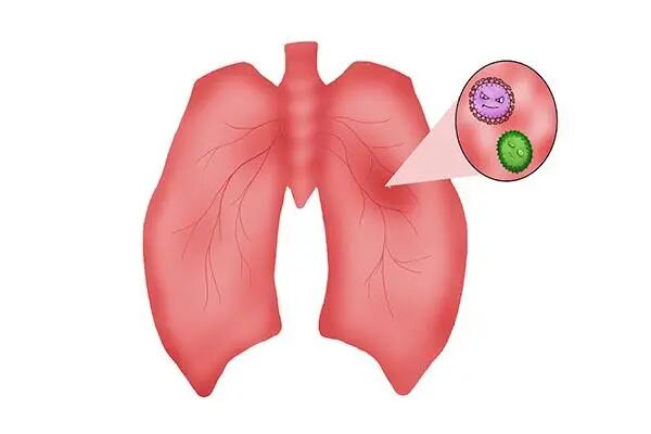 为什么要使用制氧机家用制氧机，有没有必要买？_https://www.jmylbn.com_新闻资讯_第2张