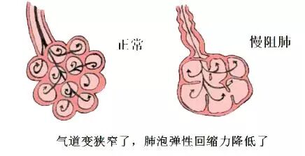 氧疗是什么氧疗对人体到底有多重要？什么情况下需要氧疗，你都知道吗？_https://www.jmylbn.com_新闻资讯_第1张