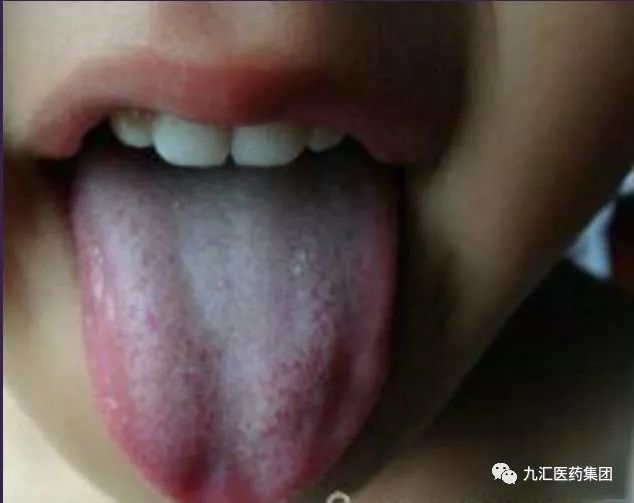 小儿舌诊 九汇医药集团 微信公众号文章阅读 Wemp