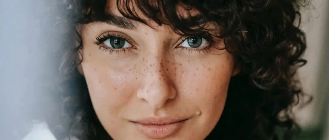 黄褐斑该怎么解决？4个证型、5套用药方案赶紧学起来！