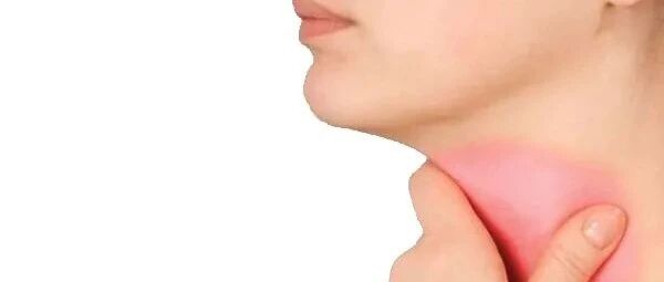 慢性咽炎不一定要用“阿莫西林”，这些用药方案更适用！