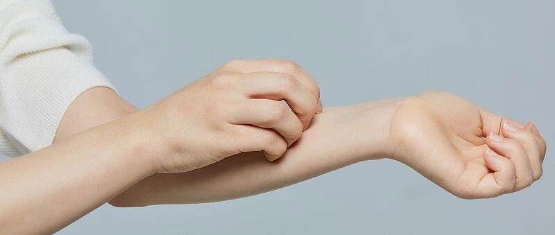 湿疹用药种类繁多，如何“精准匹配”顾客？（内附详细用药建议及卖点）