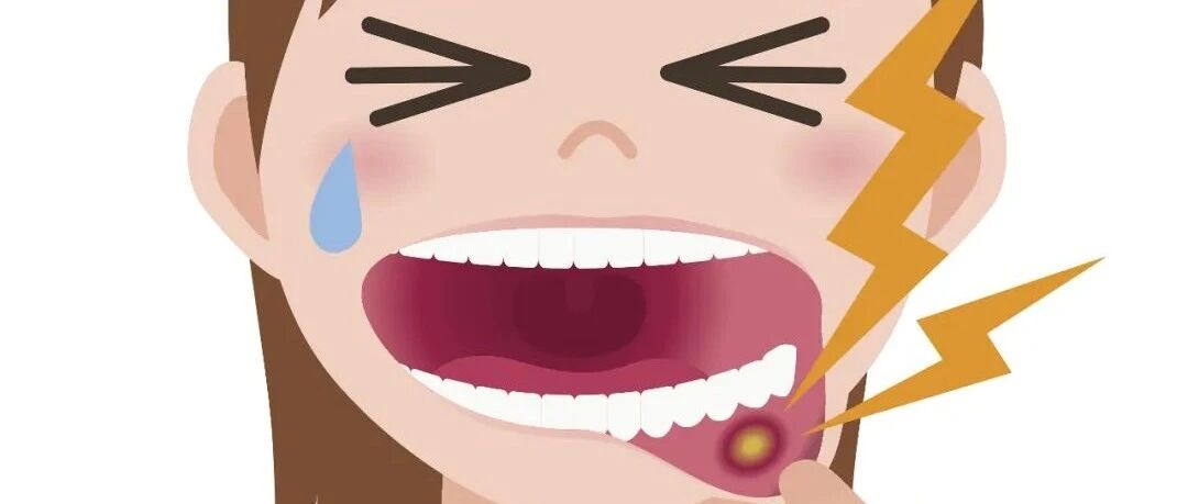 口腔溃疡，推荐对症药物+Vc还是搭Vb？不同情况搭配不同！