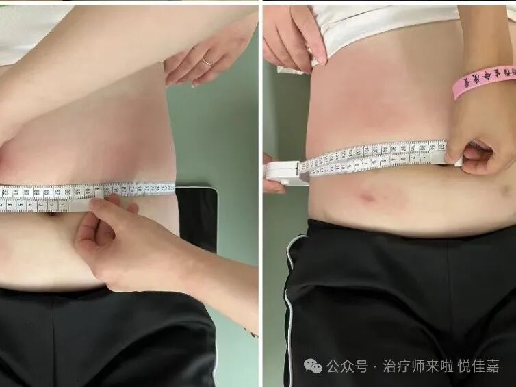 产后康复治疗是什么【孕产康复认证课程】第4期.孕产功能障碍的整体康复评估与治疗_https://www.jmylbn.com_新闻资讯_第35张