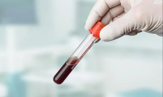 降钙素原测定是什么一分钟了解降钙素原_https://www.jmylbn.com_新闻资讯_第2张