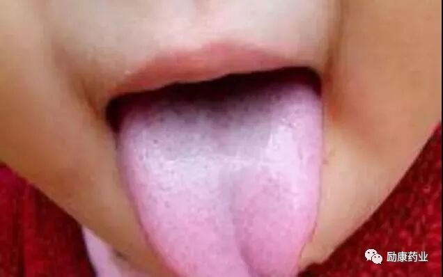 珍贵的舌诊大全 图文并茂 教您看懂舌头 励康药业 微信公众号文章阅读 Wemp