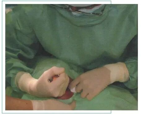 拔牙的细致流程详解