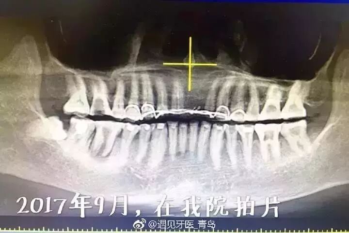 口腔莆田系？盘点牙科里的那些虚假宣传