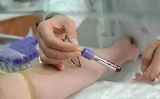 这些饮食因素会影响电解质检查:检查前须尽.. - lunaxia的主页