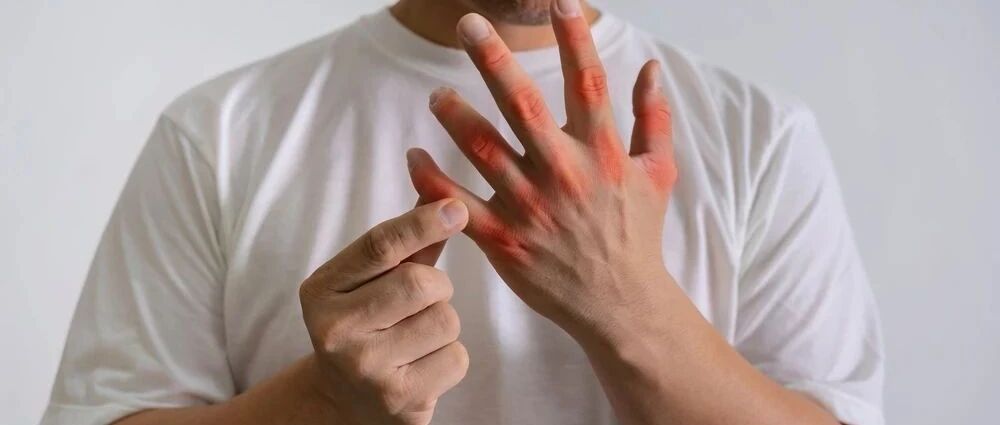 高尿酸血症 & 痛风：临床必备 8 问答