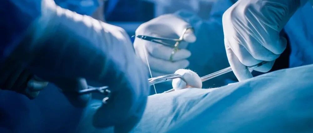 这个被国外指南淘汰十几年的手术，终于被踢出中国专家共识