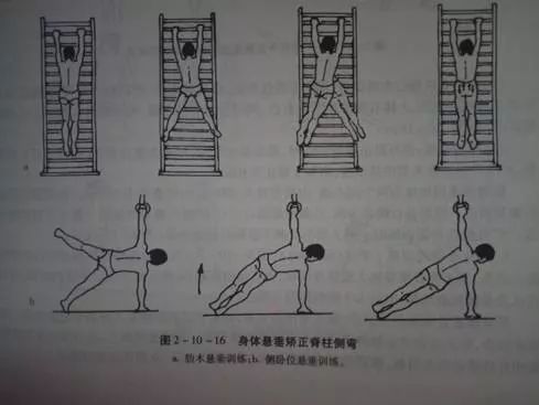 医疗体操之脊柱侧弯的矫正训练 全球康复资讯 微信公众号文章阅读 Wemp