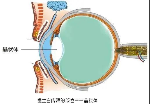 眼睛晶体是什么东西图片