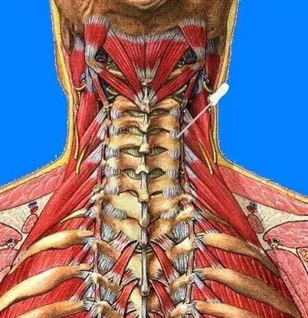 外展枕怎么使用干货 ｜ 针刀治疗要点规程定点定位_https://www.jmylbn.com_新闻资讯_第3张