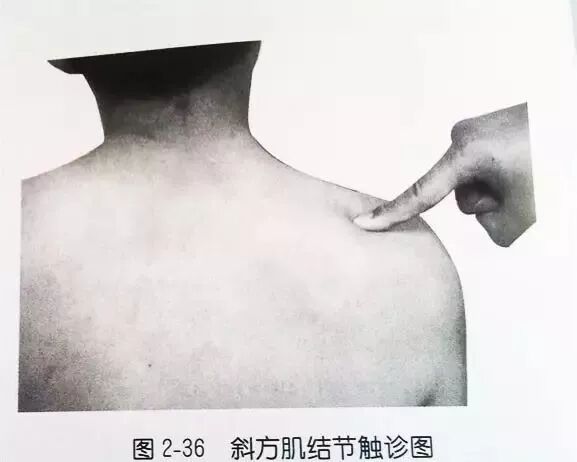 外展枕怎么使用干货 ｜ 针刀治疗要点规程定点定位_https://www.jmylbn.com_新闻资讯_第13张