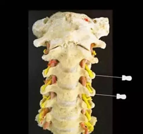 外展枕怎么使用干货 ｜ 针刀治疗要点规程定点定位_https://www.jmylbn.com_新闻资讯_第8张