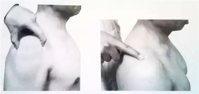 外展枕怎么使用干货 ｜ 针刀治疗要点规程定点定位_https://www.jmylbn.com_新闻资讯_第15张