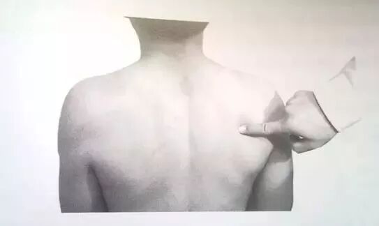 外展枕怎么使用干货 ｜ 针刀治疗要点规程定点定位_https://www.jmylbn.com_新闻资讯_第14张