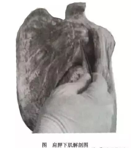 外展枕怎么使用干货 ｜ 针刀治疗要点规程定点定位_https://www.jmylbn.com_新闻资讯_第39张