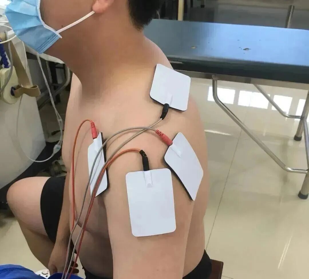 中频为什么能镇痛肩周炎（冻结肩）的综合诊疗思路_https://www.jmylbn.com_新闻资讯_第16张