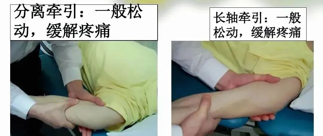 中频为什么能镇痛肩周炎（冻结肩）的综合诊疗思路_https://www.jmylbn.com_新闻资讯_第17张