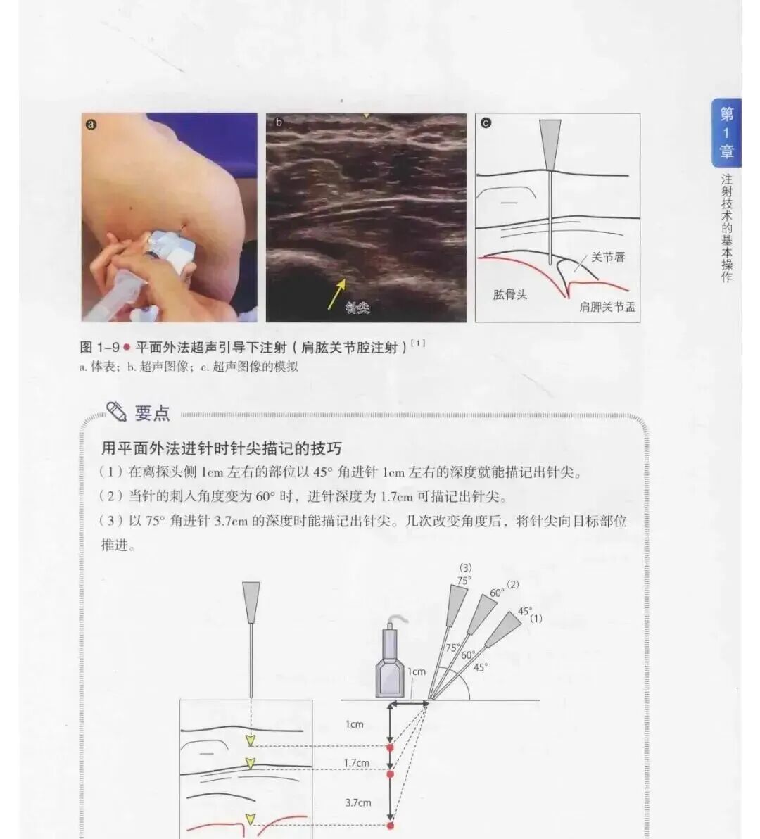 中频为什么能镇痛肩周炎（冻结肩）的综合诊疗思路_https://www.jmylbn.com_新闻资讯_第20张