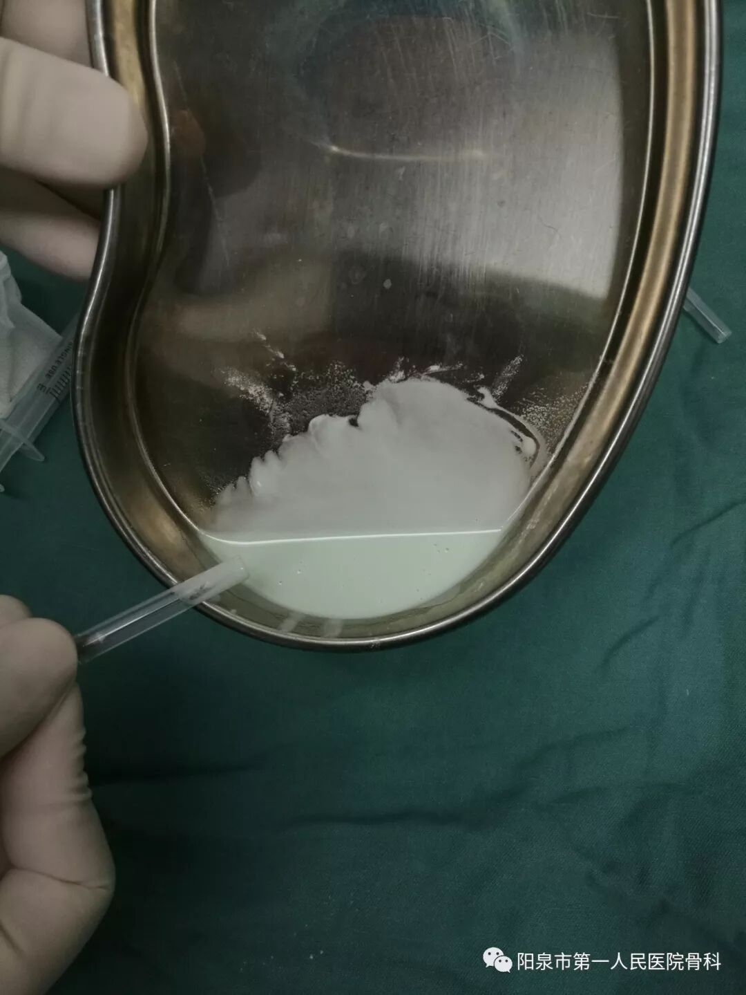 椎体成型需要哪些器材椎体成形术概述_https://www.jmylbn.com_新闻资讯_第10张