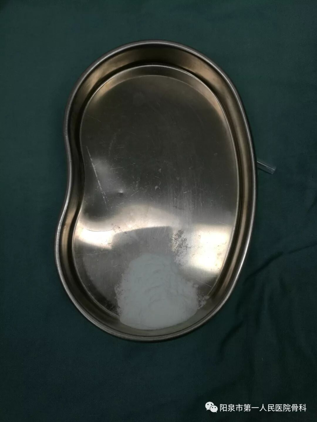 椎体成型需要哪些器材椎体成形术概述_https://www.jmylbn.com_新闻资讯_第9张