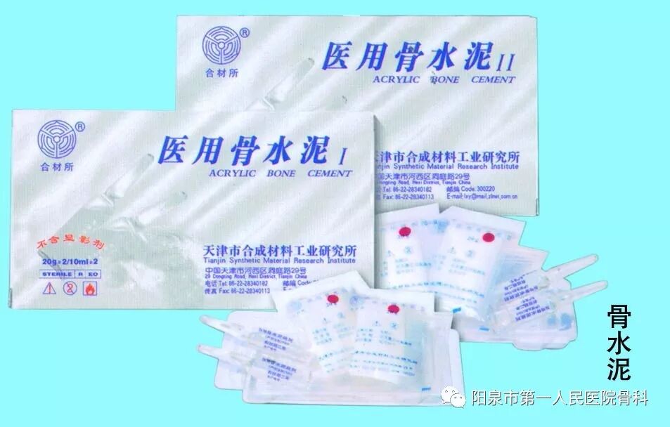 椎体成型需要哪些器材椎体成形术概述_https://www.jmylbn.com_新闻资讯_第4张